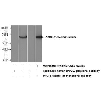 SPOCK2 Rabbit Polyclonal Antibody (11725-1-AP)