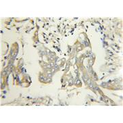 FBXW2 Rabbit Polyclonal Antibody (11499-1-AP)