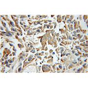 TOLLIP Rabbit Polyclonal Antibody (11315-1-AP)