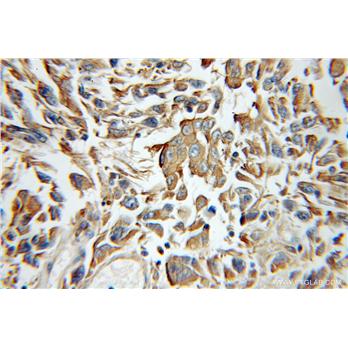 TOLLIP Rabbit Polyclonal Antibody (11315-1-AP)