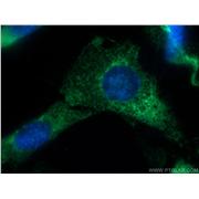 EXOSC10 Rabbit Polyclonal Antibody (11178-1-AP)