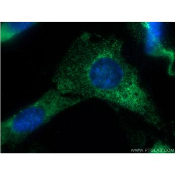 EXOSC10 Rabbit Polyclonal Antibody (11178-1-AP)