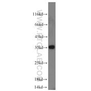 SUMF2 Rabbit Polyclonal Antibody (11210-1-AP)