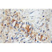 UBE2D1 Rabbit Polyclonal Antibody (11373-1-AP)