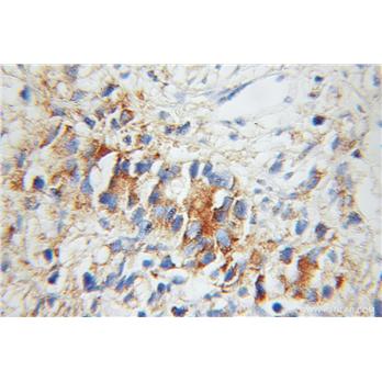 UBE2D1 Rabbit Polyclonal Antibody (11373-1-AP)