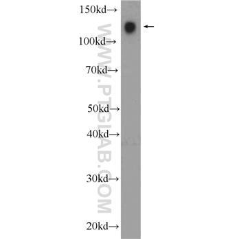 PECAM1 Rabbit Polyclonal Antibody (11265-1-AP)