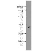 HAT1 Rabbit Polyclonal Antibody (11432-1-AP)