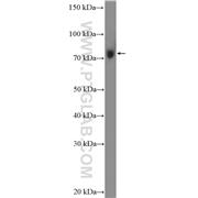 DHX58 Rabbit Polyclonal Antibody (11355-1-AP)