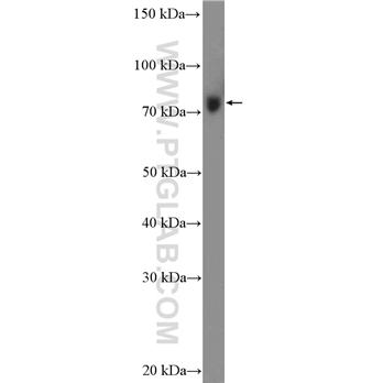 DHX58 Rabbit Polyclonal Antibody (11355-1-AP)