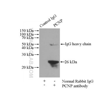PCNP Rabbit Polyclonal Antibody (11180-2-AP)