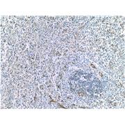 VCAM1 Rabbit Polyclonal Antibody (11444-1-AP)