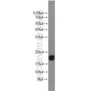 FXYD7 Rabbit Polyclonal Antibody (11465-1-AP)