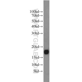 FXYD7 Rabbit Polyclonal Antibody (11465-1-AP)