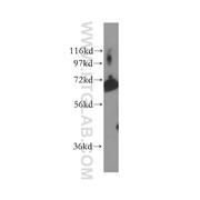POF1B Rabbit Polyclonal Antibody (11398-1-AP)