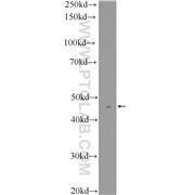 ACY1 Rabbit Polyclonal Antibody (11316-1-AP)