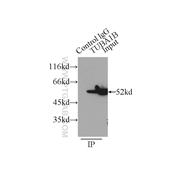 TUBA1B Rabbit Polyclonal Antibody (11224-1-AP)