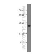 CMPK1 Rabbit Polyclonal Antibody (11360-1-AP)