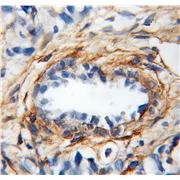GSN Rabbit Polyclonal Antibody (11644-2-AP)