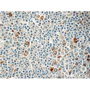 RRM2 Rabbit Polyclonal Antibody (11661-1-AP)