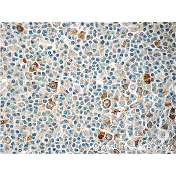RRM2 Rabbit Polyclonal Antibody (11661-1-AP)