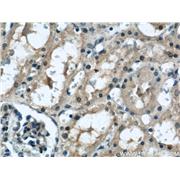 TAX1BP3 Rabbit Polyclonal Antibody (11692-1-AP)