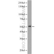 LPXN Rabbit Polyclonal Antibody (11307-1-AP)