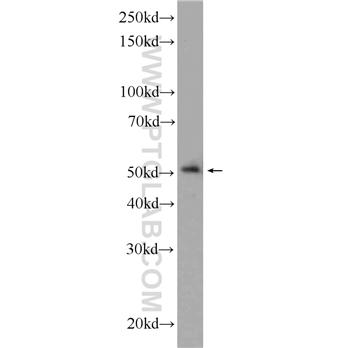 LPXN Rabbit Polyclonal Antibody (11307-1-AP)