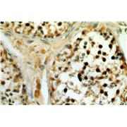 SETDB1 Rabbit Polyclonal Antibody (11231-1-AP)
