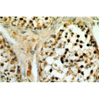 SETDB1 Rabbit Polyclonal Antibody (11231-1-AP)