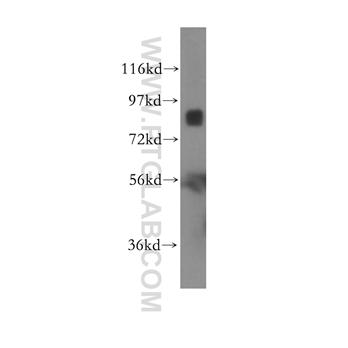 ITGB7 Rabbit Polyclonal Antibody (11328-1-AP)