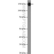 CADPS Rabbit Polyclonal Antibody (11490-2-AP)