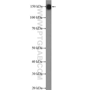 CADPS Rabbit Polyclonal Antibody (11490-2-AP)