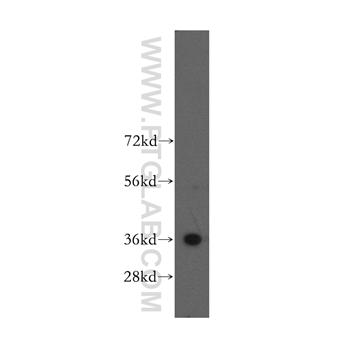 MNAT1 Rabbit Polyclonal Antibody (11719-1-AP)