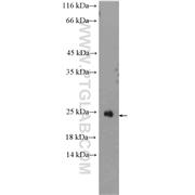 RAX2 Rabbit Polyclonal Antibody (11466-1-AP)