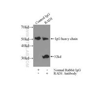 RAD1 Rabbit Polyclonal Antibody (11726-2-AP)