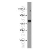 NCAPH Rabbit Polyclonal Antibody (11515-1-AP)