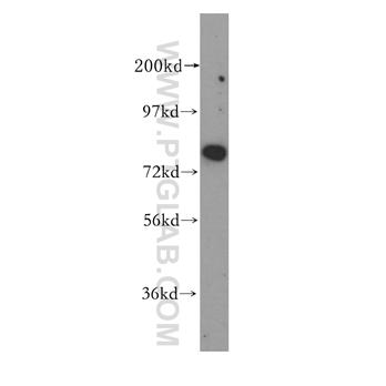 NCAPH Rabbit Polyclonal Antibody (11515-1-AP)