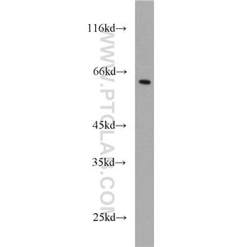 MEIS2 Rabbit Polyclonal Antibody (11550-1-AP)