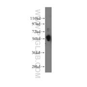 CREB3L1 Rabbit Polyclonal Antibody (11235-2-AP)