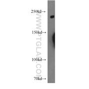 DOCK8 Rabbit Polyclonal Antibody (11622-1-AP)