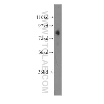 OSBPL11 Rabbit Polyclonal Antibody (11318-1-AP)