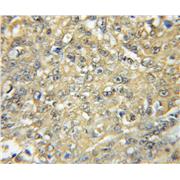 HCK Rabbit Polyclonal Antibody (11600-1-AP)