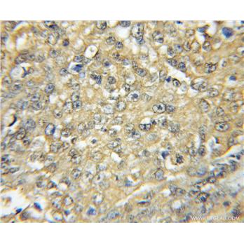 HCK Rabbit Polyclonal Antibody (11600-1-AP)