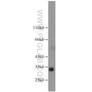 AKR1C3 Rabbit Polyclonal Antibody (11194-1-AP)