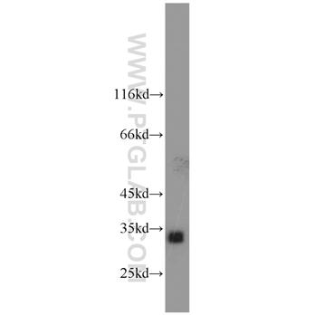 AKR1C3 Rabbit Polyclonal Antibody (11194-1-AP)