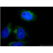 ARF4 Rabbit Polyclonal Antibody (11673-1-AP)