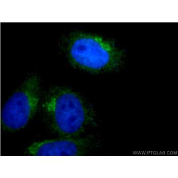 ARF4 Rabbit Polyclonal Antibody (11673-1-AP)
