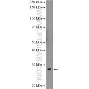 MOBKL1B Rabbit Polyclonal Antibody (11669-1-AP)