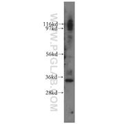 GTF2E2 Rabbit Polyclonal Antibody (11596-1-AP)