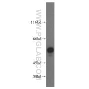 FKBP8 Rabbit Polyclonal Antibody (11173-1-AP)
